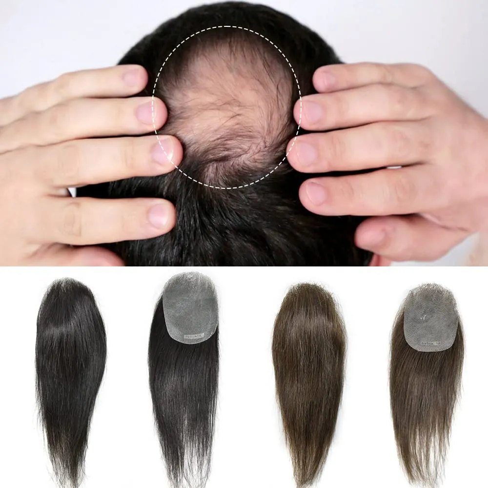 Bald Spot Hair Patch For Men V-Looped Remy Human Hair Patch For Bald Spot Natural lookimg Hair Replacement Unit Thin Skin Hair Piece for Bald Spot Hair Systems (#4 MEDIUM BROWN, 4cm X 8cm - 6 INCH)