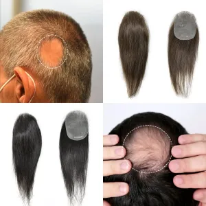 Bald Spot Hair Patch For Men V-Looped Remy Human Hair Patch For Bald Spot Natural lookimg Hair Replacement Unit Thin Skin Hair Piece for Bald Spot Hair Systems (#4 MEDIUM BROWN, 4cm X 8cm - 6 INCH)