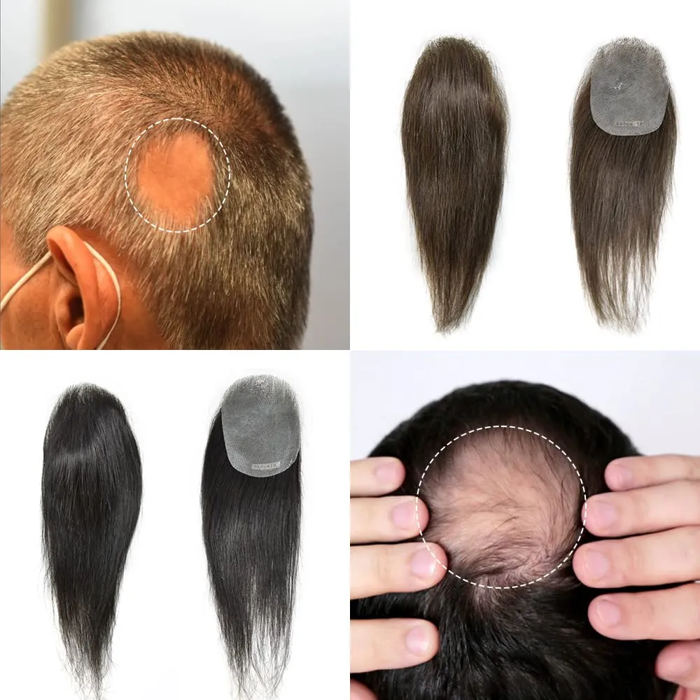 Bald Spot Hair Patch For Men V-Looped Remy Human Hair Patch For Bald Spot Natural lookimg Hair Replacement Unit Thin Skin Hair Piece for Bald Spot Hair Systems (#4 MEDIUM BROWN, 4cm X 8cm - 6 INCH)