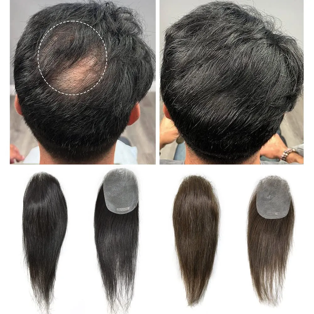 Bald Spot Hair Patch V-Looped Remy Human Hair Patch For Bald Spot Natural lookimg Hair Replacement Unit Thin Skin Hair Piece for Bald Spot Hair Systems (6cmx8cm-14“, #1B OFF BLACK)