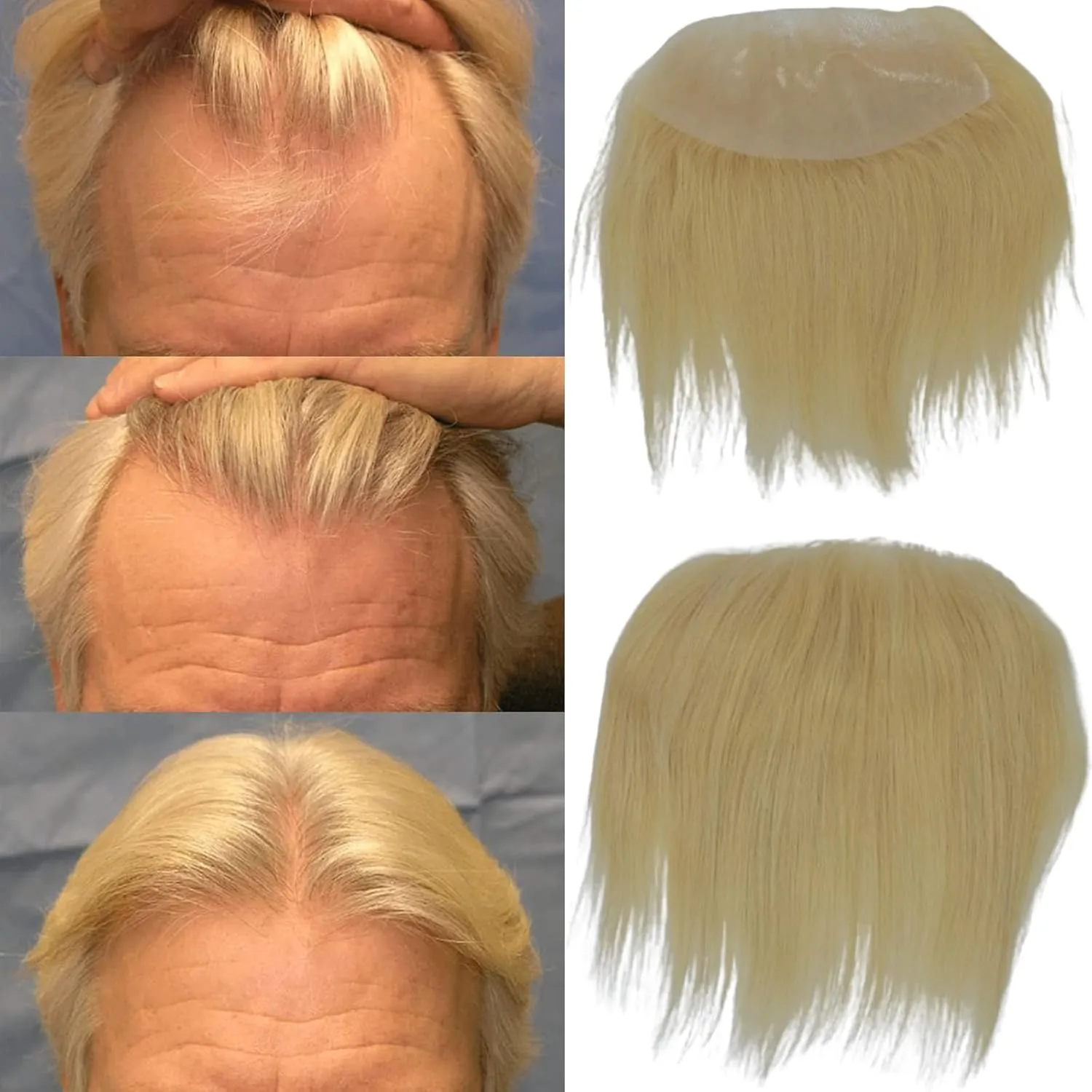 Men Forehead Hairline Toupee 100% Human Hair Skin PU Man Hairpieces Frontal Hair Topper for Receding Natural Hairline Replacement Systems (2.75x6.29 Inch, #613 Blonde Color)
